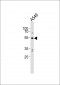 PPP2R2C Antibody (Center)